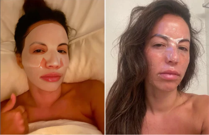BiocollagenPlus  Máscara Absorvível de Colágeno  Ativos do Botox