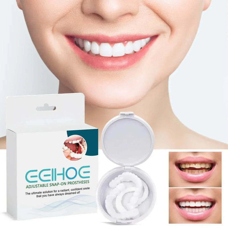 Facetas Dentárias Naturais Removíveis SmileFix Pro
