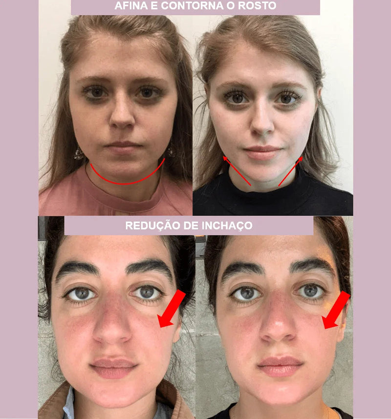 Máscara de Contorno Facial Suaviza Rugas e Papada Modela o Rosto