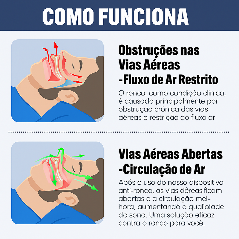 Protetor Bucal Anti-Ronco Ajustável para Noite Alívio do Ronco e Bruxismo Sono Restaurador